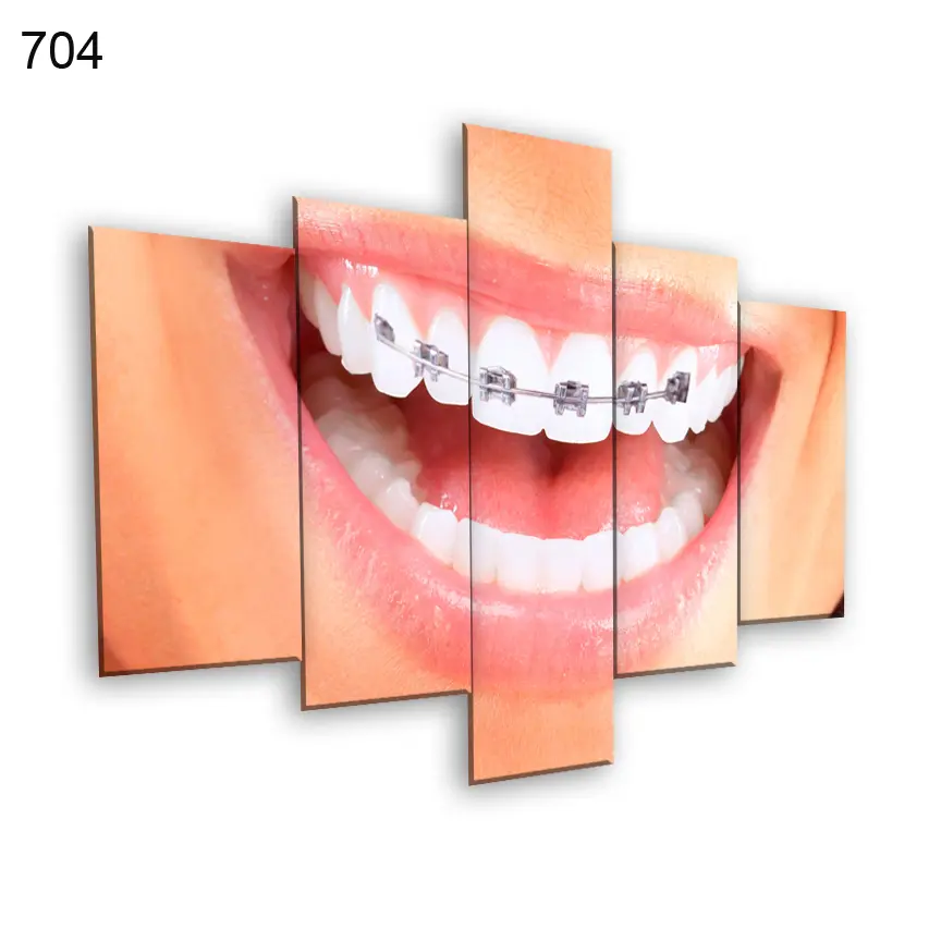 لوحات عيادة الاسنان 704:لوحة عيادة الأسنان من خمس اطارات