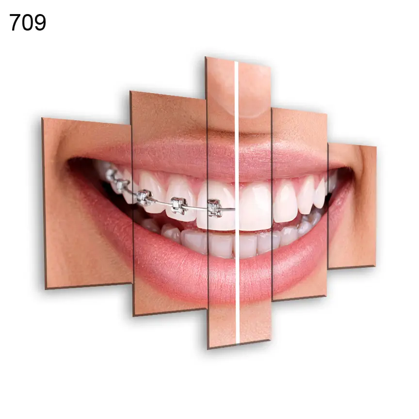 لوحات عيادة الاسنان 709:لوحة عيادة الأسنان من خمس اطارات