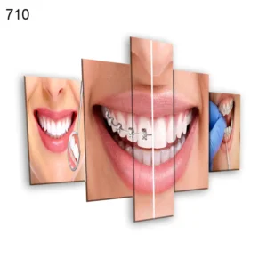 710:لوحة عيادة الأسنان من خمس اطارات