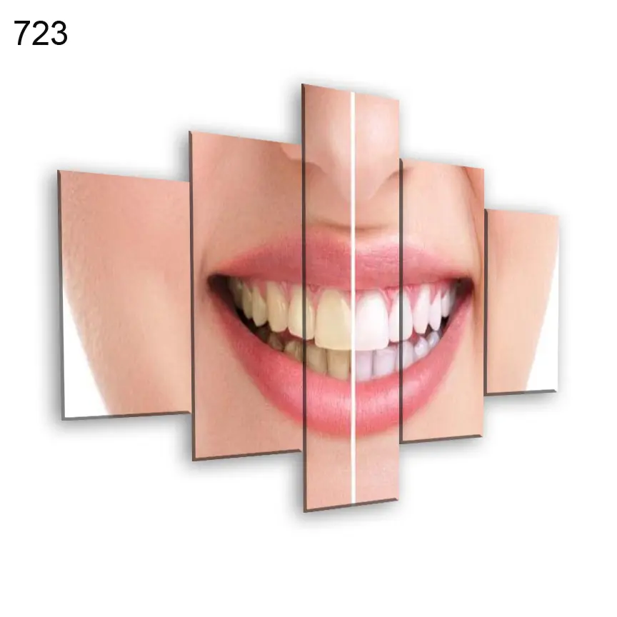 لوحات عيادة الاسنان 723:لوحة عيادة الأسنان من خمس اطارات