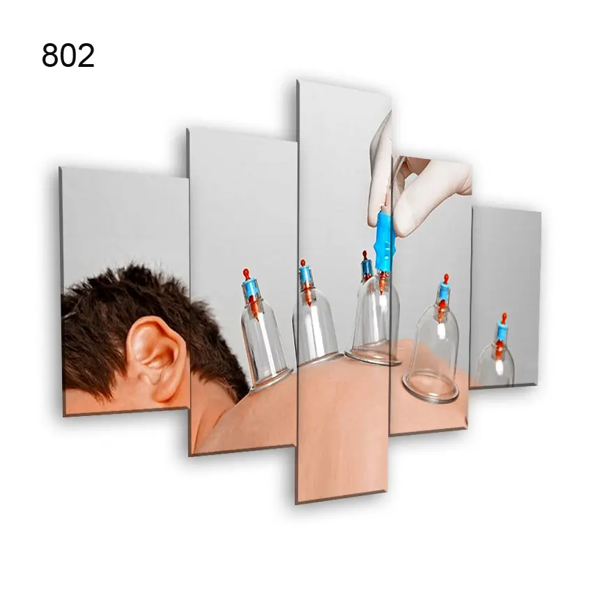 802:لوحة الحجامة من خمس اطارات